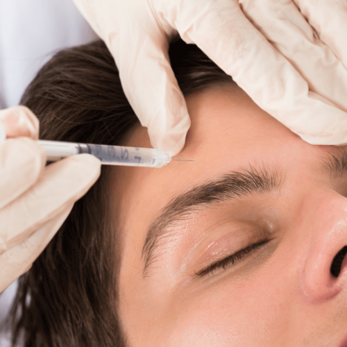 Na imagem que simboliza a estética masculina, um homem aparece realizando a aplicação do Botox em seu terço superior da face, ou seja, na região da testa.
