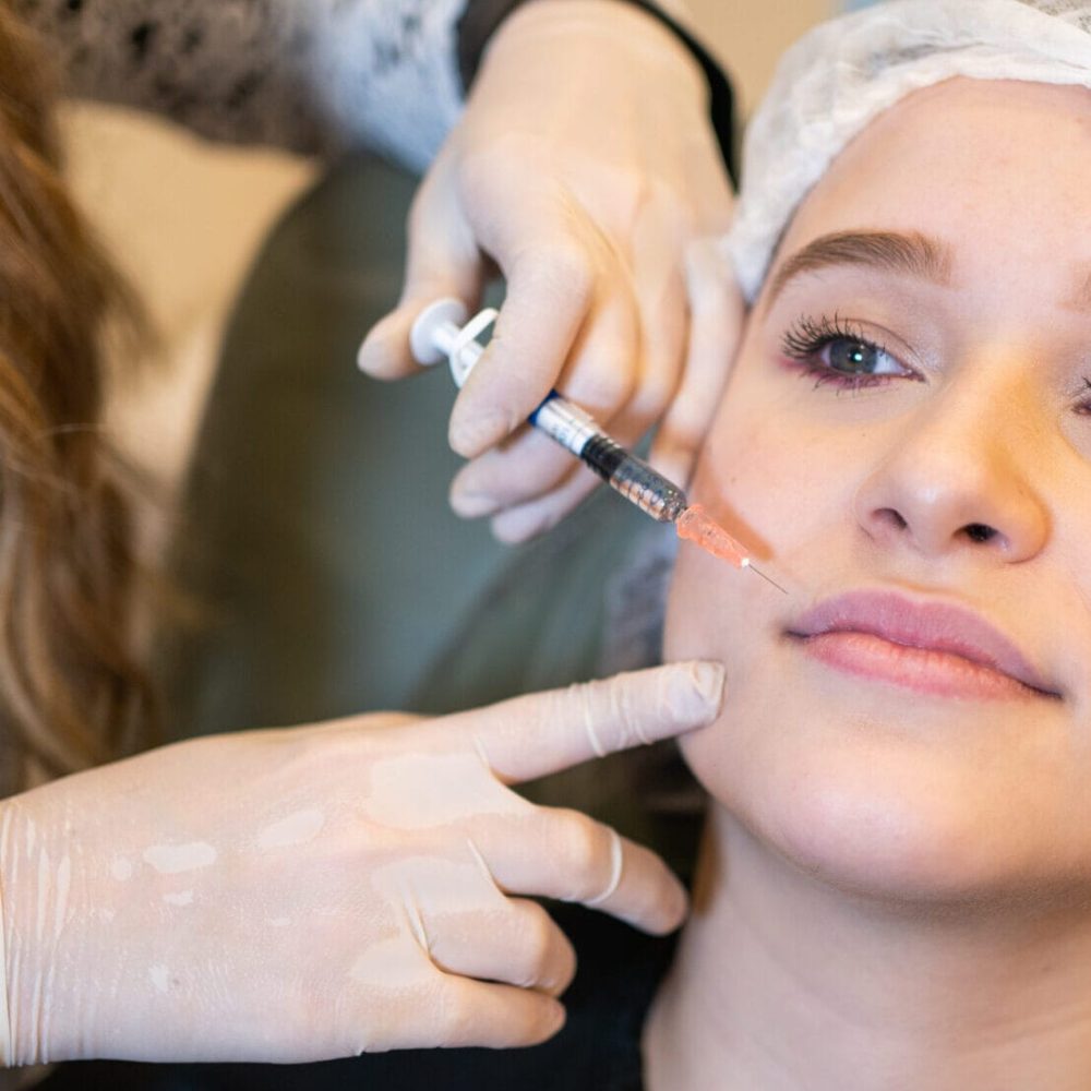 Preenchimento Labial