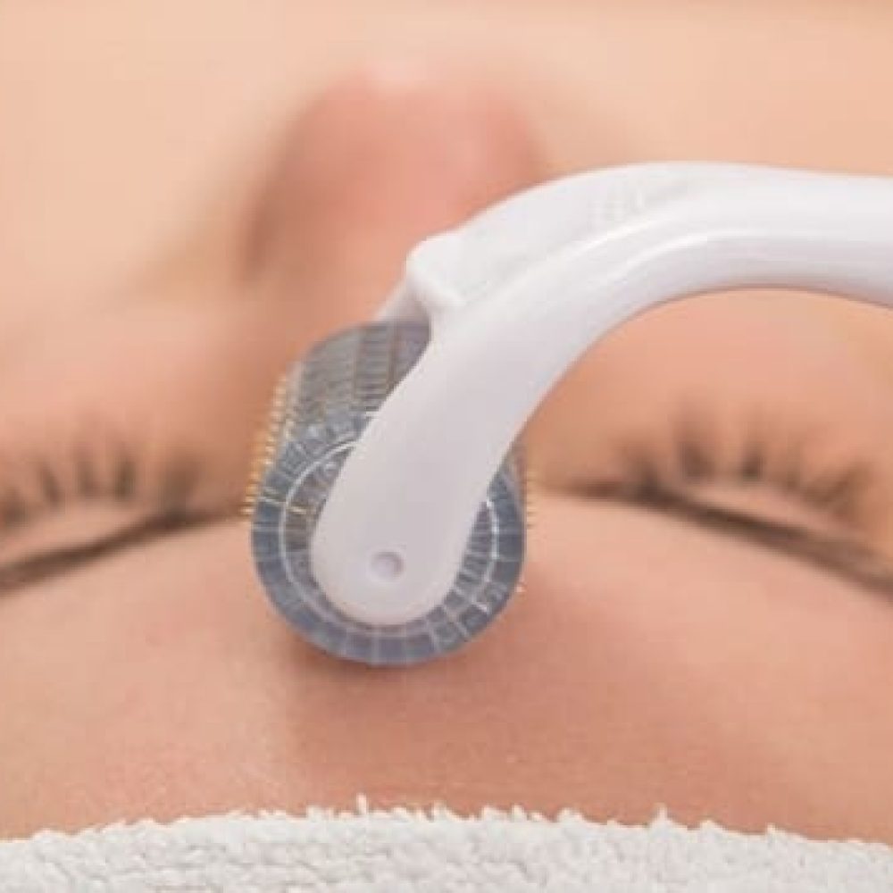 dermaroller-microagulhamento-em-sao-paulo-768x356